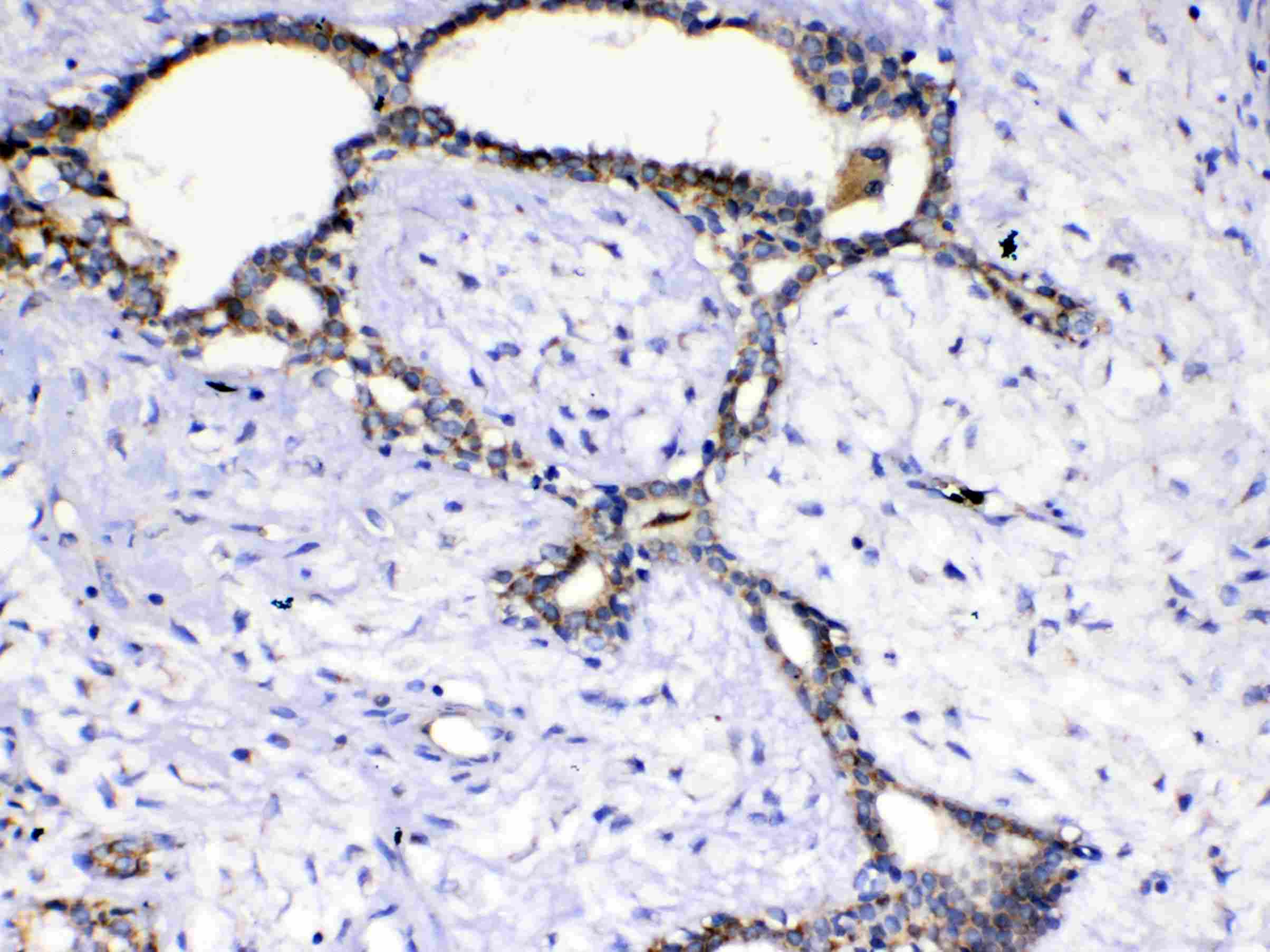 Polyclonal Rabbit anti-Human KITLG / SCF Antibody (IHC, WB)