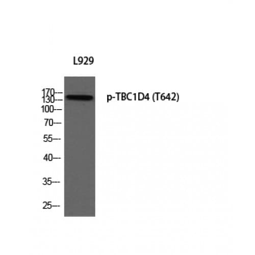 TBC1D4 / AS160 Antibody (580-660 aa)