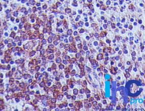 Monoclonal Mouse anti-Human VISA / MAVS Antibody (clone 58N3B6, aa93-276, IHC, WB)