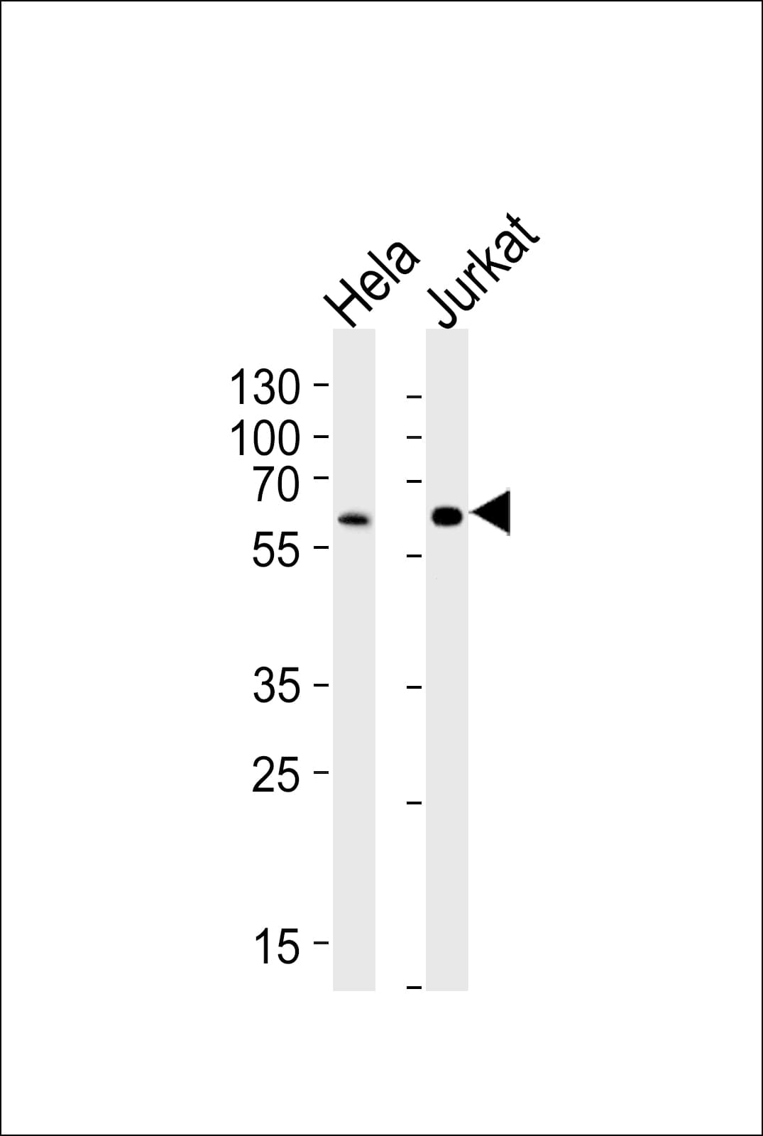 Heparanase 2 / HPSE2 Antibody (aa451-480)