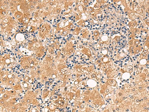 FUNDC2 Antibody