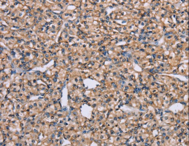 ADAM29 Antibody