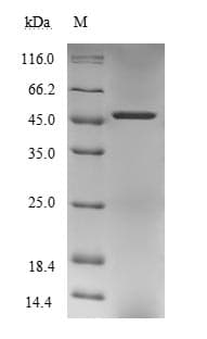 Human PPM1A / PP2CA Protein (Recombinant GST, N-terminus)
