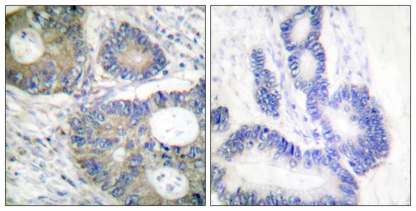 Polyclonal Rabbit anti-Human EIF4EBP1 / 4EBP1 Antibody (p64, IHC, WB)