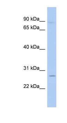 GRG4 / TLE4 Antibody (aa215-264)