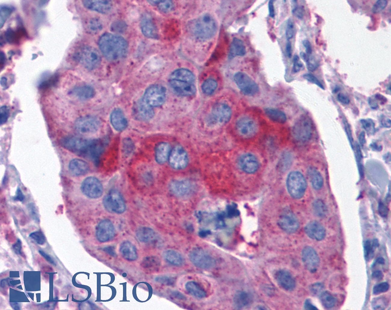 PathPlus™ CCKBR / Cckb Antibody (Extracellular Domain)