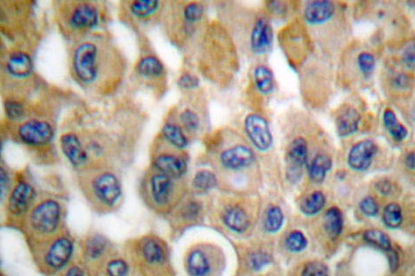 PTGS2 / COX2 / COX-2 Antibody (Thr594)