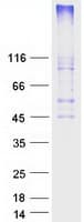 Human HCAR2 / NIACR1 Protein (Recombinant Myc-DDK (Flag))
