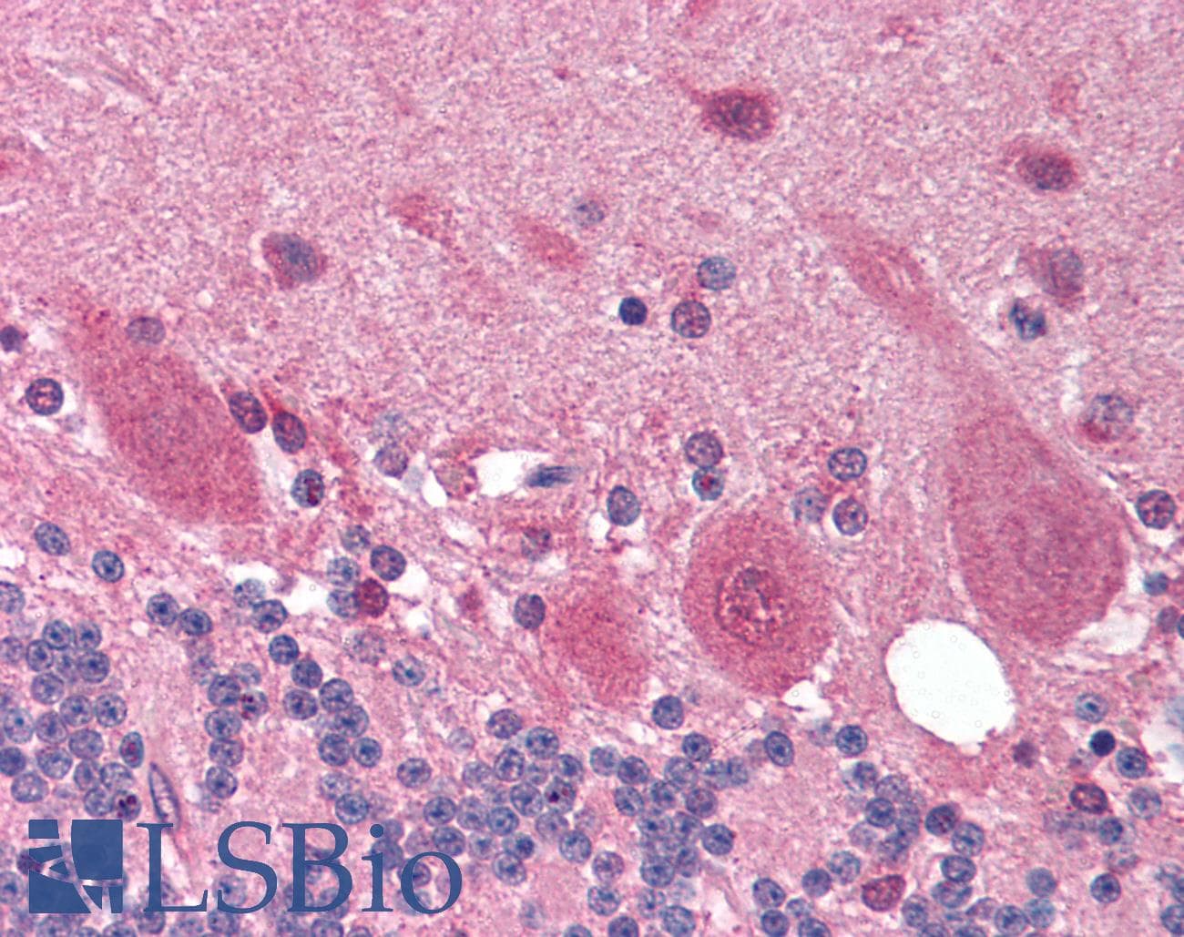IHC-plus™ OPTN / Optineurin Antibody (aa575-591)