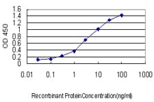 Monoclonal Mouse anti-Human PDE3A Antibody (clone 5C12)