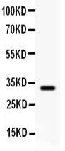 GSTP1 / GST Pi Antibody (aa2-210)