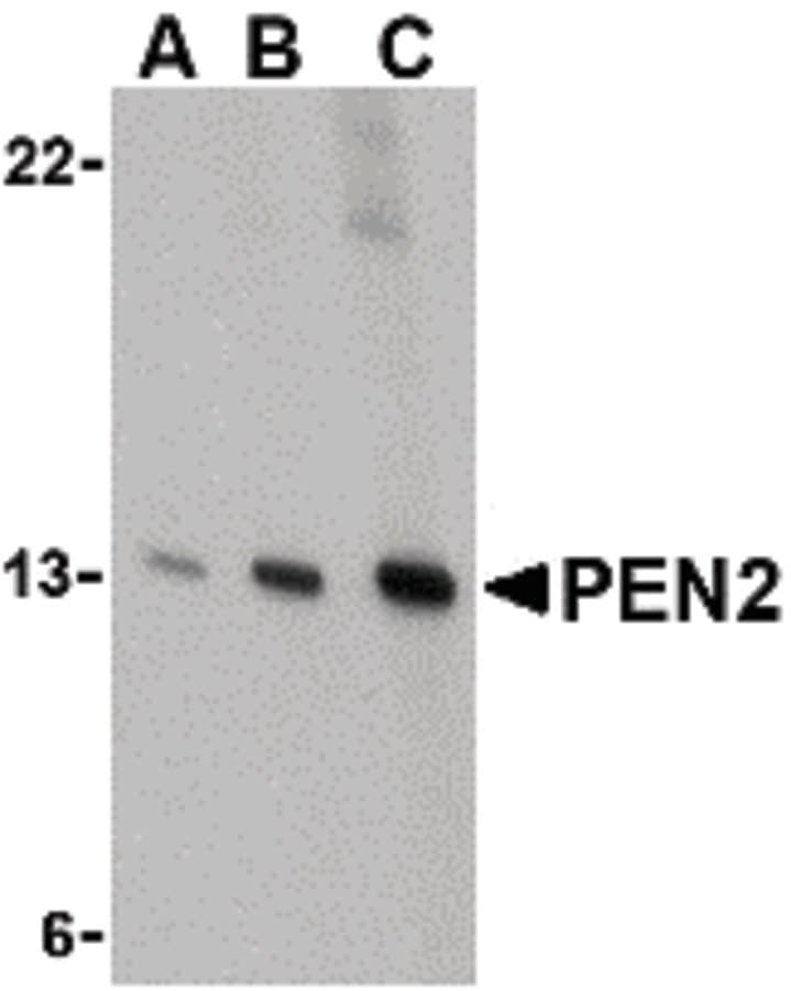 Polyclonal Rabbit anti-Human PSENEN / PEN-2 Antibody (IF, WB)
