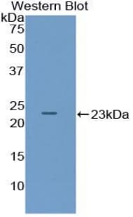 PACAP Antibody (aa1-175)