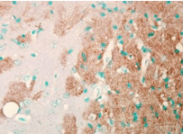Monoclonal Mouse anti-Human SCN9A / Nav1.7 Antibody (clone S68-6, IHC, WB)