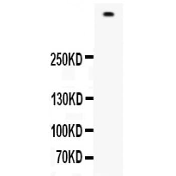 FLG / Filaggrin Antibody (aa1-261)
