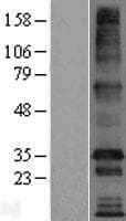 TMEM169 Protein (Over-Expression Lysate Myc-DDK (Flag))