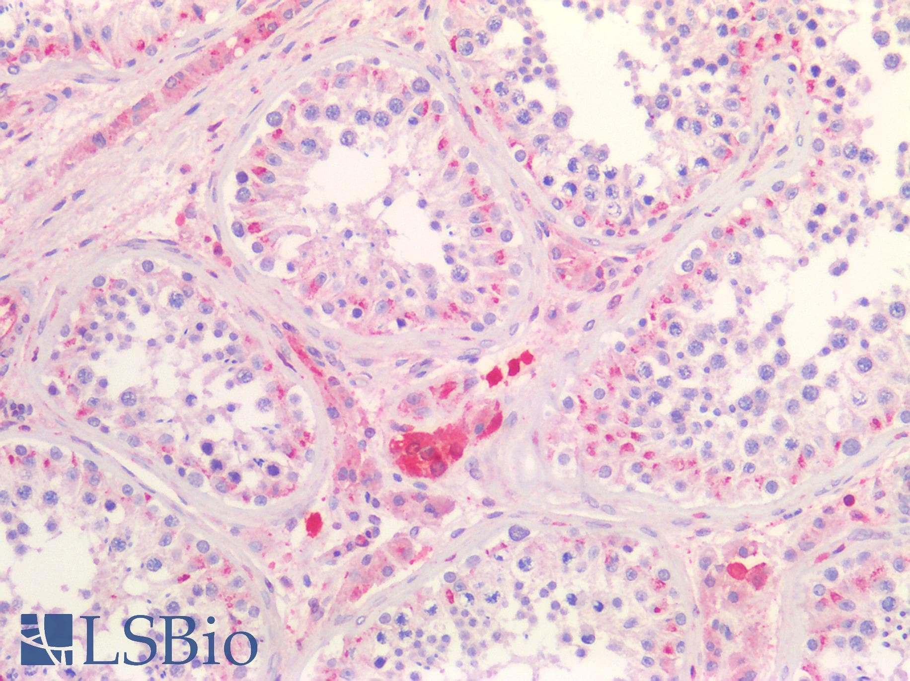 IHC-plus™ SCARB1 / SR-BI Antibody (C Terminus)