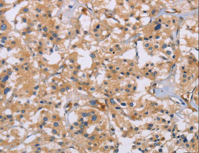ACTN4 Antibody