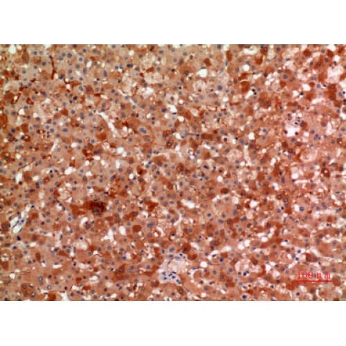 A2M / Alpha-2-Macroglobulin Antibody (Internal)