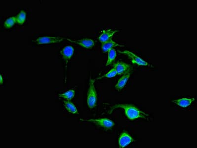PAK3 Antibody