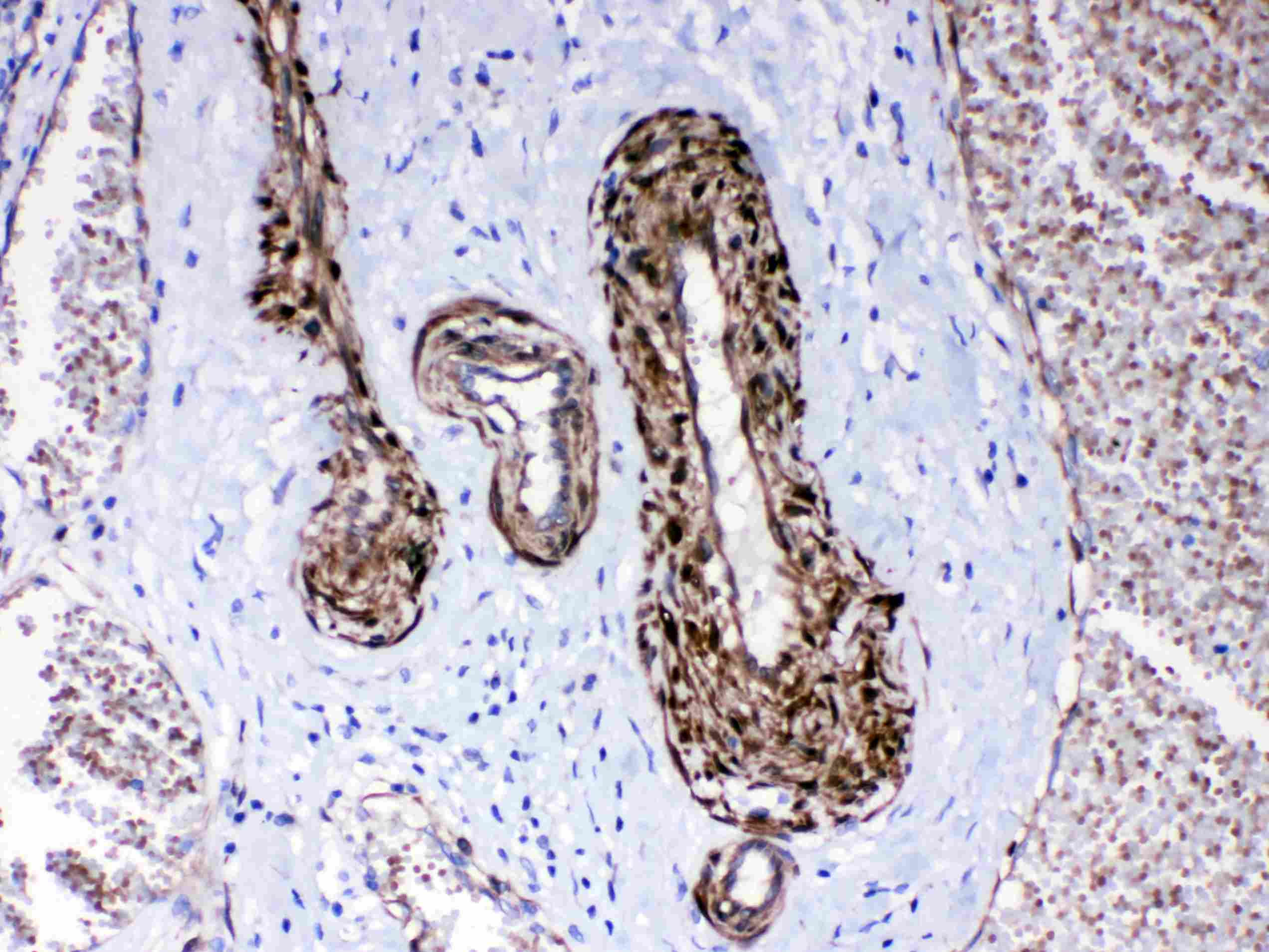 PPP1R14A / CPI-17 Antibody