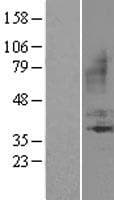 B1R / BDKRB1 Protein (Over-Expression Lysate Myc-DDK (Flag))
