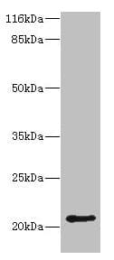 HDDC3 Antibody (aa2-140)