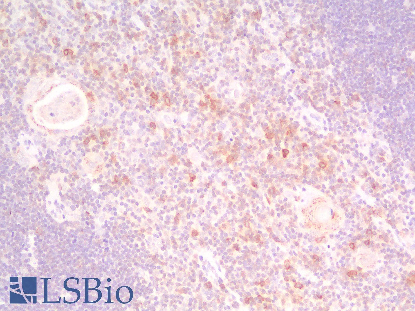 PathPlus™ Monoclonal Mouse anti-Human PDCD1 / CD279 / PD-1 Antibody (Concentrated, IHC)