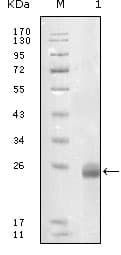 FBLN5 / Fibulin 5 Antibody (clone 1G6A4)