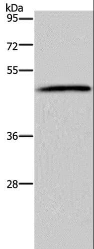 HTR2B / 5-HT2B Receptor Antibody