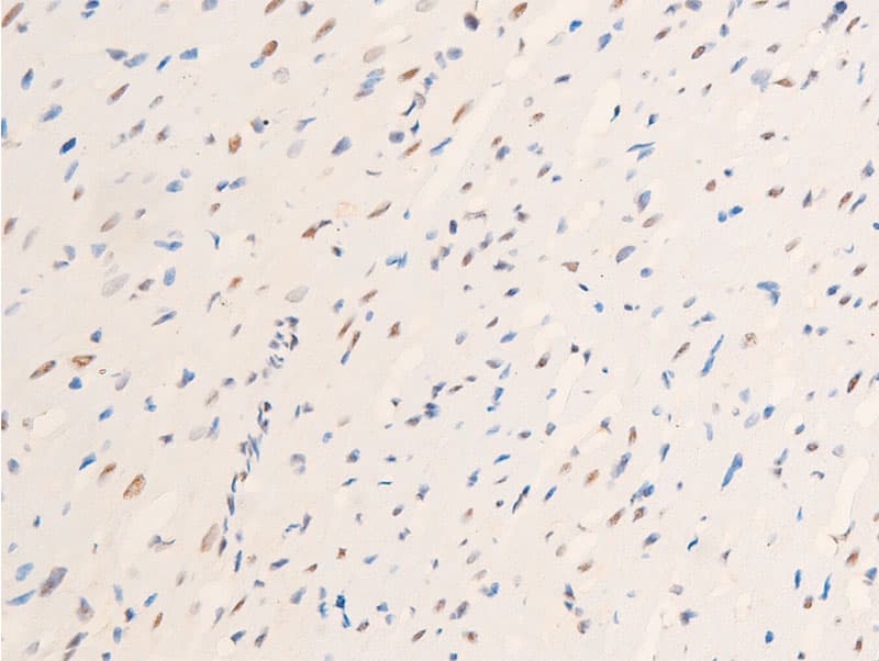 JUN / c-Jun Antibody (phospho-Thr239)