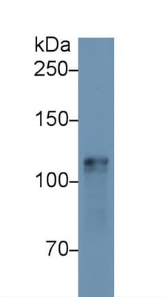 HK1 / Hexokinase 1 Antibody (aa137-270, Biotin)