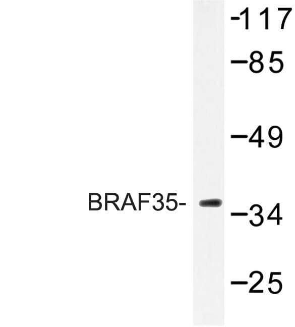 HMG20B / BRAF35 Antibody (Thr29)