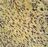 CCDC62 Antibody (aa651-679)