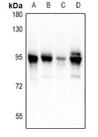 Polyclonal Rabbit anti-Human PDXDC1 Antibody (IHC, WB)