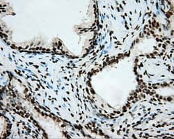 ARNT / HIF-1-Beta Antibody (clone OTI1A1)