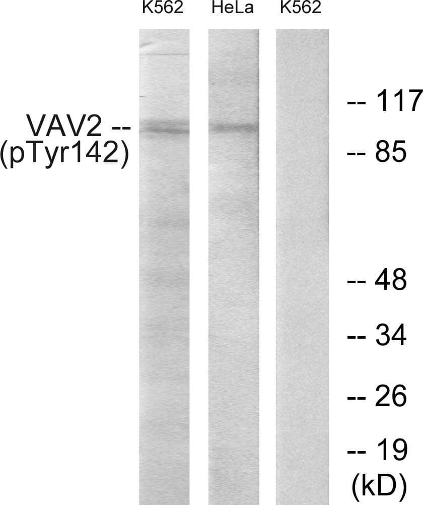 VAV2 Antibody (phospho-Tyr142)