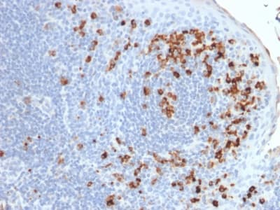 Kappa Light Chain Antibody (clone rKLC264)
