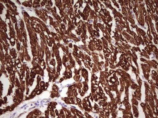 TNNI1 Antibody (clone OTI8H8)