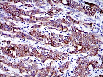KRT19 / CK19 / Cytokeratin 19 Antibody (clone 400000000)