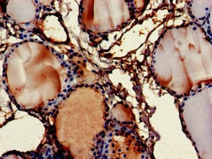 Polyclonal Rabbit anti-Human FMOD / Fibromodulin Antibody (IHC, WB)