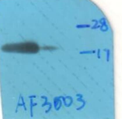 HSPB6 / HSP20 Antibody (phospho-Ser16)