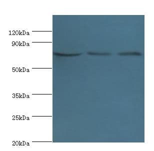 NCL / Nucleolin Antibody (aa411-710)