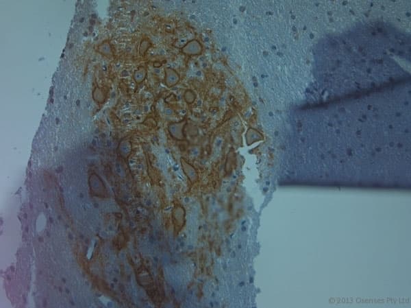 Polyclonal Rabbit anti-Human ACAN / Aggrecan Antibody (aa200-250, IHC)