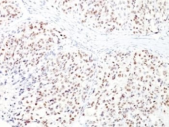 MITF Antibody (N-Terminus, clone D5 + MITF/915)
