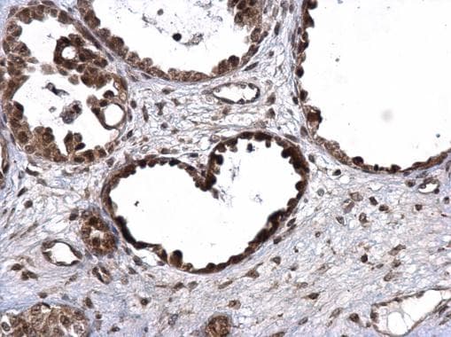 E6AP / UBE3A Antibody (aa34-422)