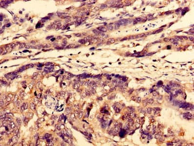 WDFY3 / ALFY Antibody
