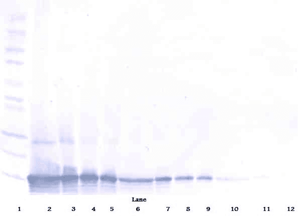 Polyclonal Rabbit anti-Human CCL25 / TECK Antibody (Biotin, WB)