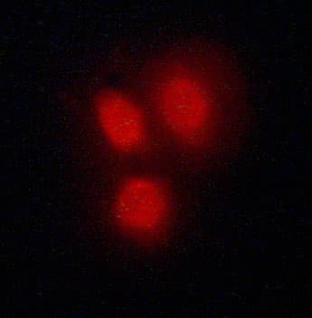 Vitamin D Receptor / VDR Antibody