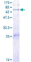 Human GLI4 Protein (Recombinant GST)